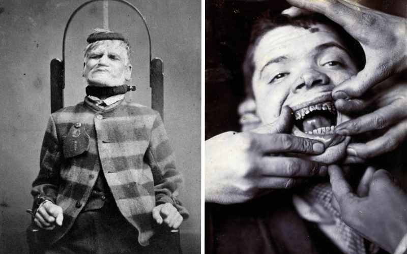 You are currently viewing 15 пугающих фотографий, сделанных в психиатрических лечебницах прошлого
